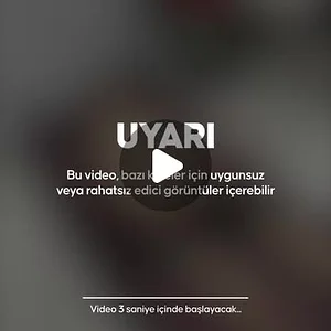 Anadolu Ajansı, Instagram: "İsrail’in kuşatması ve kısıtlamaları nedeniyle Gazze’de temel gıdaya erişim engelleniyor⁠ ⁠ 86 yaşındaki Filistinli Rabia Abdülkerim Aslih yetersiz beslenme sonucu yaşamını yitirdi⁠ ⁠ #anadoIuajansi #anadolu"